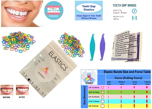 Стоматологични Орто-Еластични Гумени ленти Смесени цветове, 100 Опаковки, Покриващи празнина между зъбите (1/8 X-Heavy
