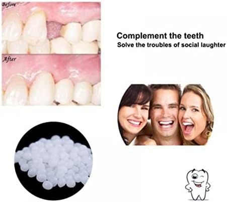 Комплект за временен ремонт на зъбен твърдо гел за попълване на грим, исправляющий Отсъствуващ Счупен зъб (30 г) (Размер: